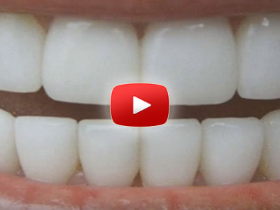 Ako si prírodne vybieliť zuby za 3 minúty